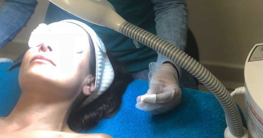 facial limpieza profunda y extracción